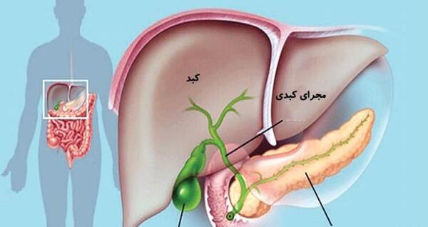 عکس عمل سنگ کیسه صفرا