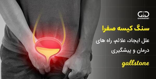 عکس سنگ در کیسه صفرا