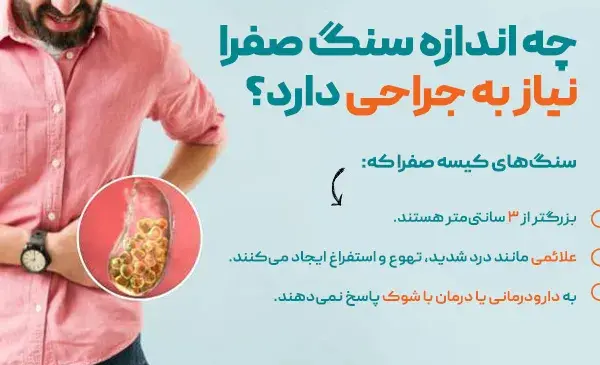 عکس سنگ در کیسه صفرا