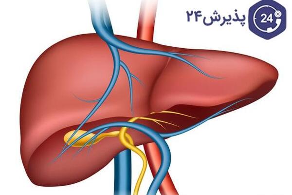 عکس سنگ های کیسه صفرا