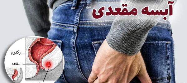 عکس جایی که ازش جیش میاد واقعی