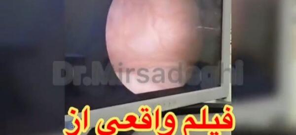 عکس جایی که ازش جیش میاد واقعی