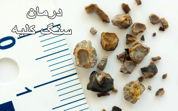 عکس سنگ گرده