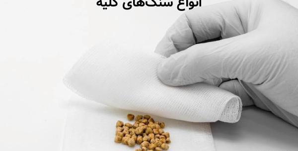 عکس سنگ گرده