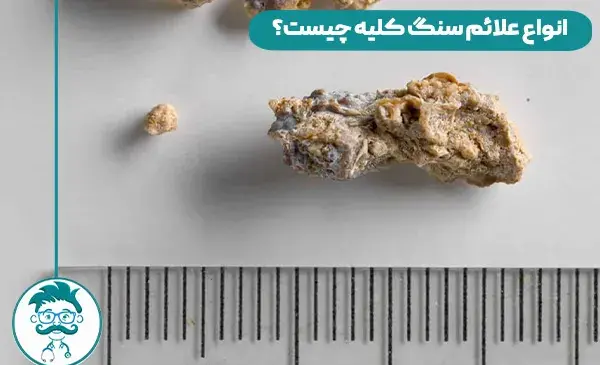 عکس سنگ گرده