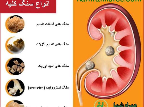 عکس سنگ گرده