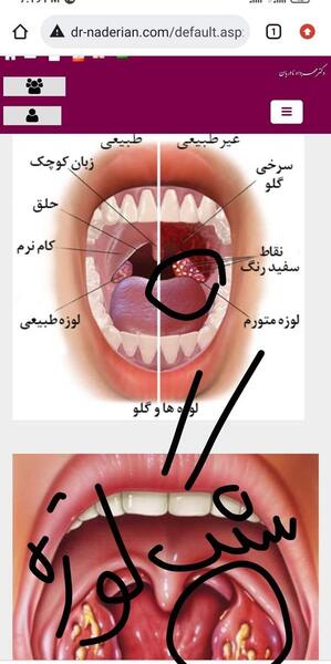 عکس سنگ لوزه نی نی سایت