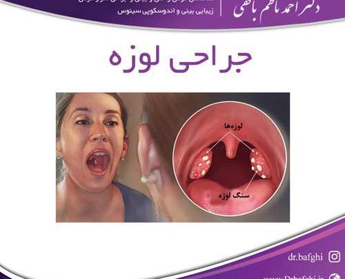 عکس سنگ لوزه در کودکان