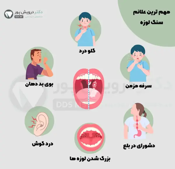 عکس سنگ لوزه در گلو