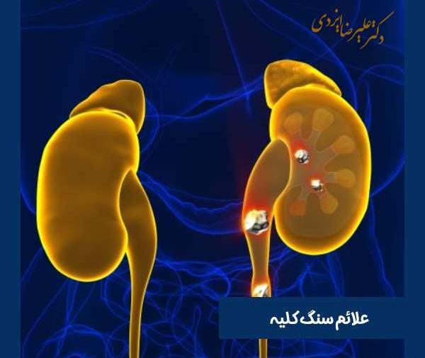 عکس سنگ مثانه در زنان