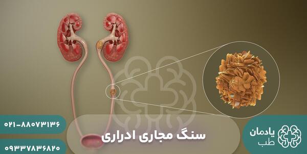 عکس سنگ در مثانه