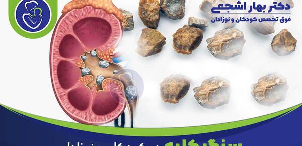 عکس سنگ کلیه در مثانه