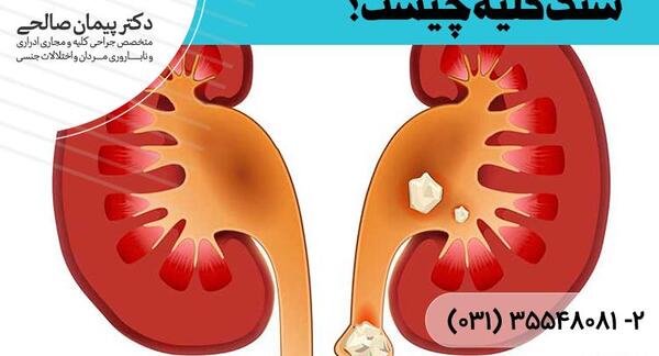 عکس سنگ کلیه در مثانه