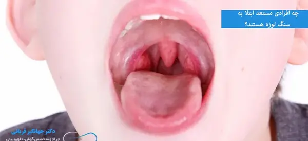 عکس سنگ لوزه ها