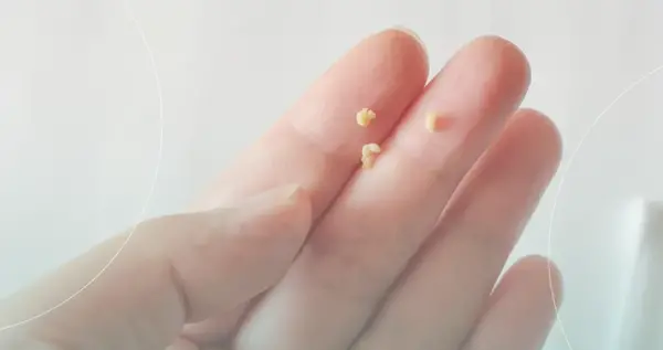 عکس عكس سنگ لوزه