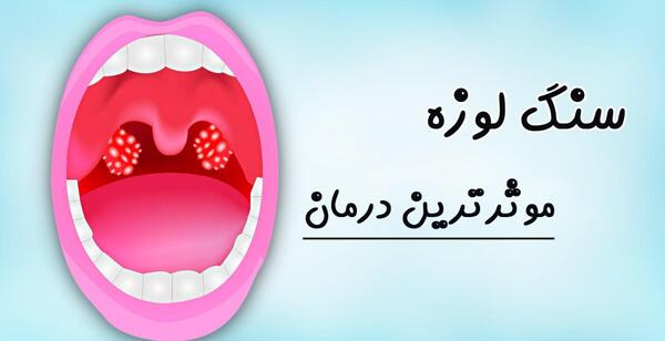 عکس سنگ لوزه پنهان