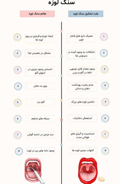 عکس سنگ لوزه پنهان