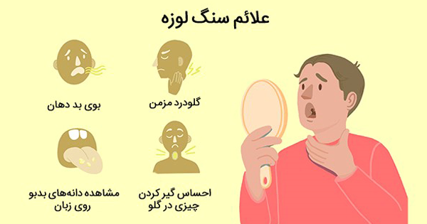 عکس سنگ لوزه کوچک