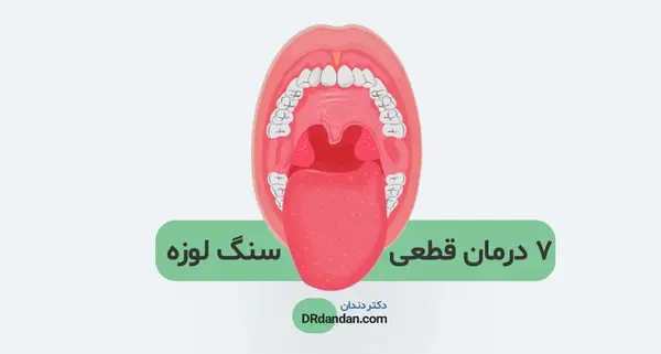 عکس سنگ لوزه کوچک