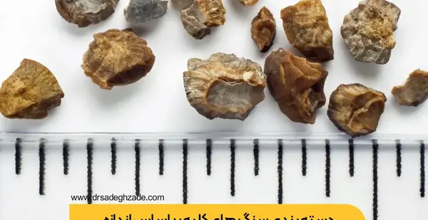 عکس سنگ کلیه 4 میلیمتری نی نی سایت