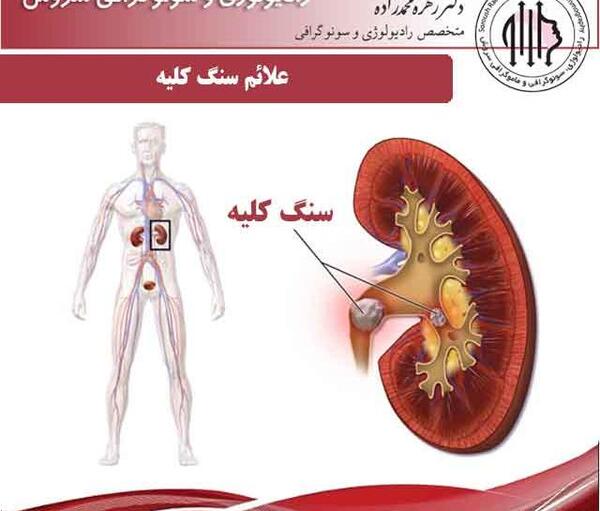 عکس سنگ کلیه در بدن انسان