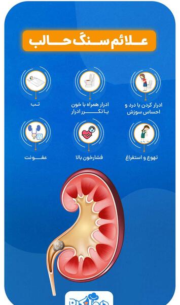 لوله حالب عکس سنگ کلیه 4 میلیمتری