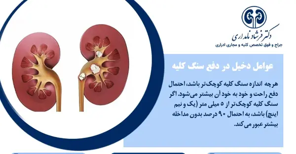 لوله حالب عکس سنگ کلیه 4 میلیمتری
