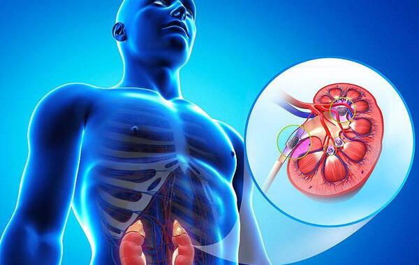 لوله حالب عکس سنگ کلیه 4 میلیمتری