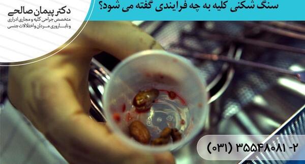 عکس سنگ شکنی کلیه