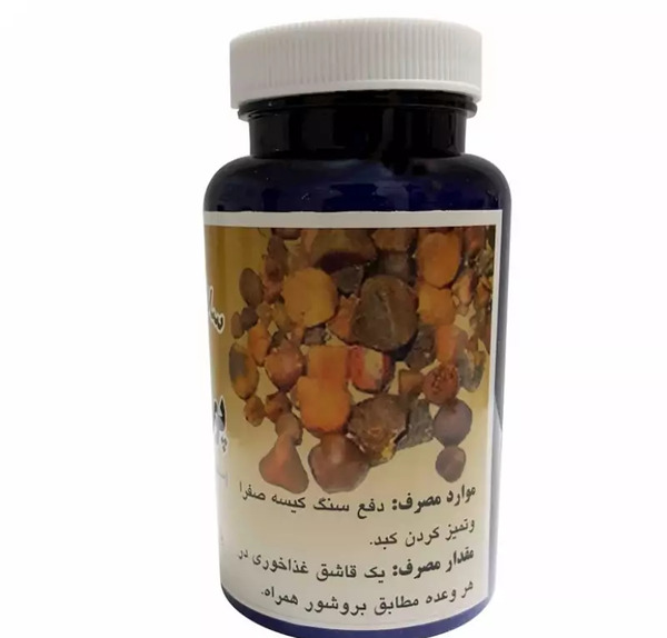 عکس سنگ صفرای گاو
