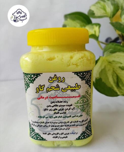 عکس سنگ صفرای گاو
