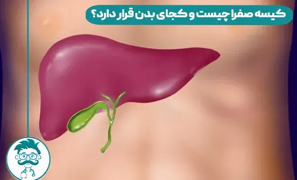 عکس سنگ کیسه صفرا چیست
