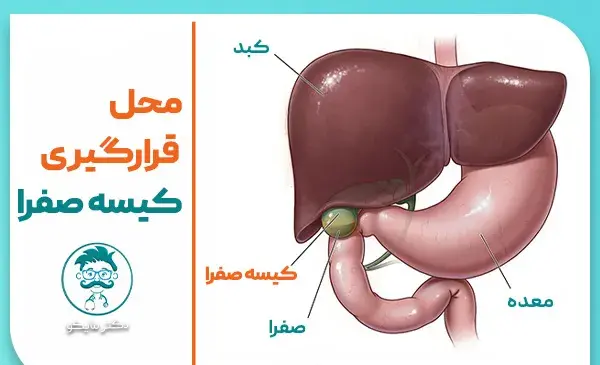 عکس سنگ کیسه صفرا چیست