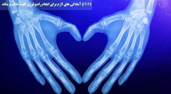 عکس رنگی سنگ کلیه