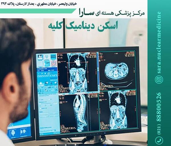 عکس سنگ کلیه در سی تی اسکن