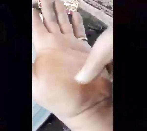 عکس انواع سنگ پادزهر