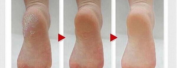 عکس سنگ پا برقی