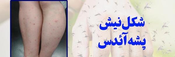 عکس نیش زدن پشه دنگی
