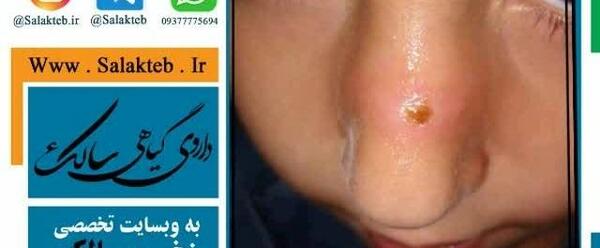 دانلود عکس پشه سالک