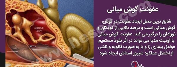 عکس داخل گوش عفونت کرده