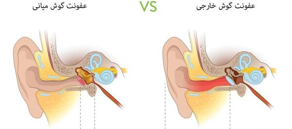 عکس داخل گوش عفونت کرده