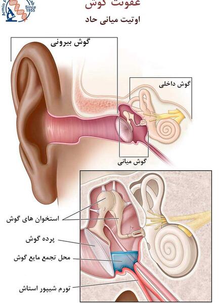 عکس داخل گوش عفونت کرده