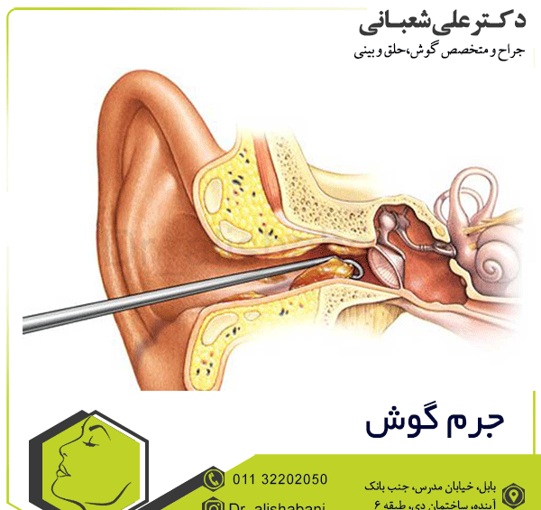 عکس داخل گوش عفونت کرده