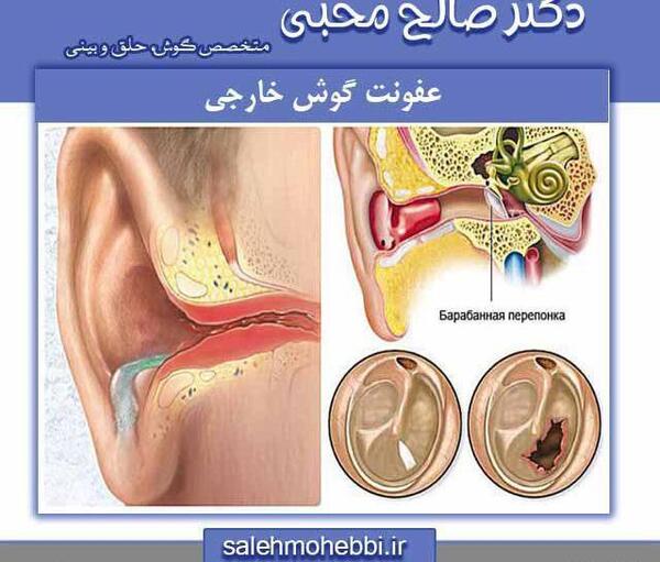 عکس داخل گوش عفونت کرده
