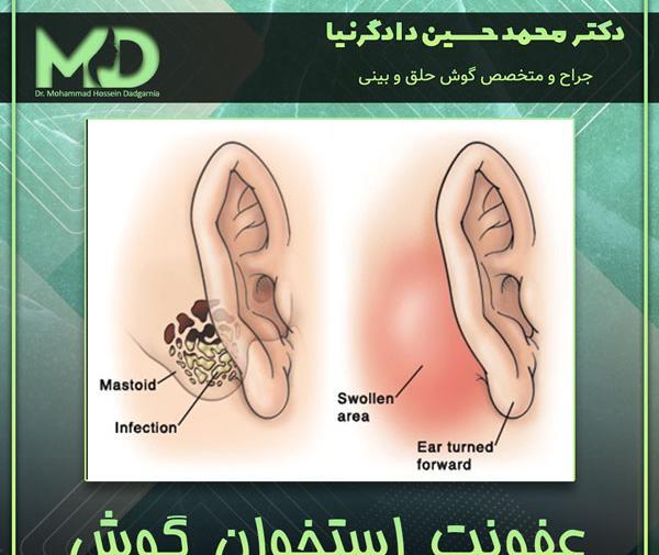 عکس داخل گوش عفونت کرده