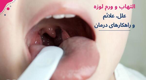 عکس داخل گلو درد