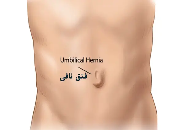 عکس داخل ناف انسان