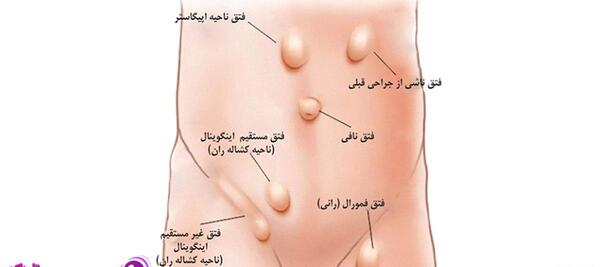 عکس ناف داخل شکم