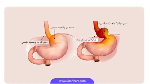 عکس ناف داخل شکم