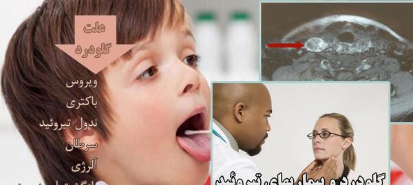 عکس عفونت داخل گلو